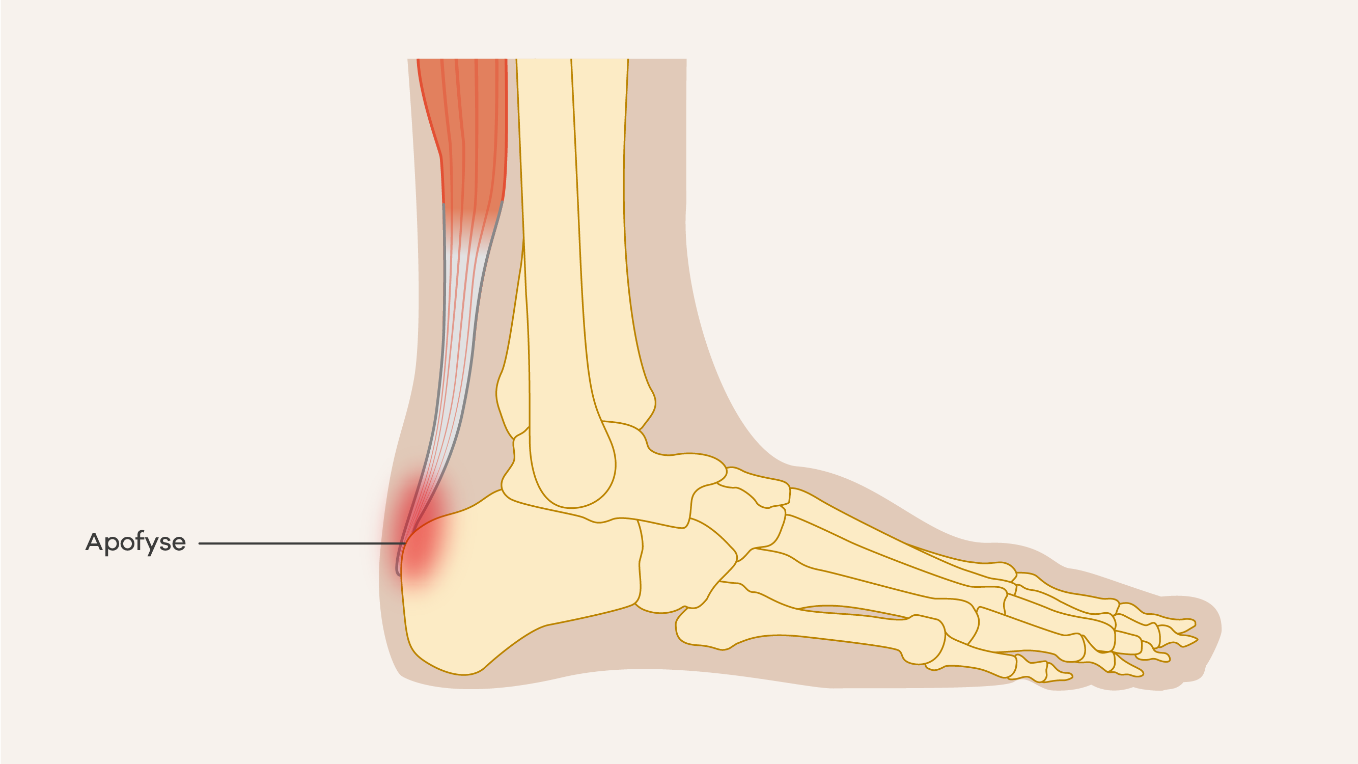 Illustratie van de ziekte van server.